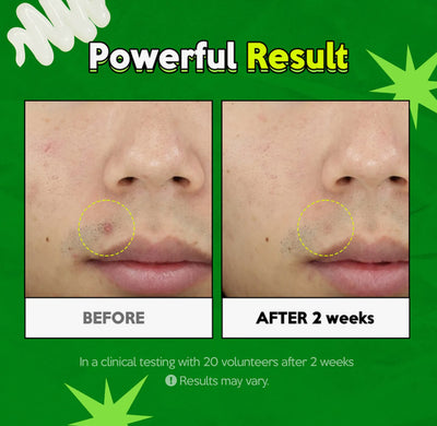 TROUBLESS - CLEAR GEL CREAM